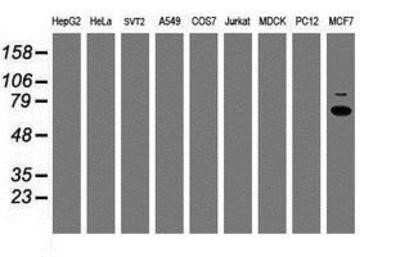 Western Blot: p70 S6 Kinase/S6K Antibody (OTI1G4) - Azide and BSA Free [NBP2-73209] - Analysis of extracts (35ug) from 9 different cell lines by using anti-S6K monoclonal antibody.