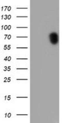 Western Blot: p70 S6 Kinase/S6K Antibody (OTI1G4) - Azide and BSA Free [NBP2-73209] - HEK293T cells were transfected with the pCMV6-ENTRY control (Left lane) or pCMV6-ENTRY S6K (Right lane) cDNA for 48 hrs and lysed. Equivalent amounts of cell lysates (5 ug per lane) were separated by SDS-PAGE and immunoblotted with anti-S6K.