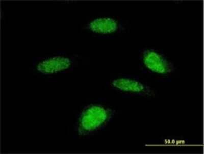 Immunocytochemistry/Immunofluorescence: p70 S6 Kinase beta/S6K2 Antibody (4B11) [H00006199-M08] - Analysis of monoclonal antibody to RPS6KB2 on HeLa cell. Antibody concentration 10 ug/ml