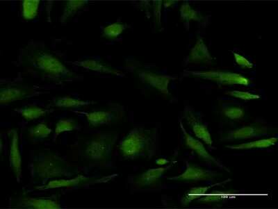 Immunocytochemistry/Immunofluorescence: p70 S6 Kinase beta/S6K2 Antibody [H00006199-B02P] - Analysis of purified antibody to RPS6KB2 on HeLa cell. (antibody concentration 10 ug/ml)