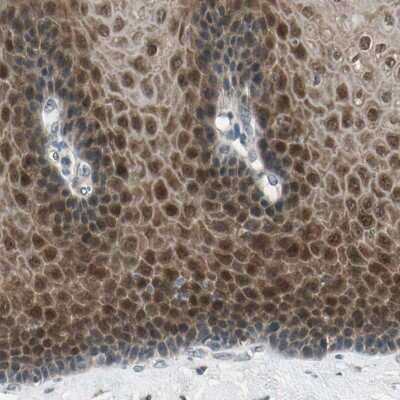 Immunohistochemistry-Paraffin: p70 S6 Kinase beta/S6K2 Antibody [NBP1-87805] - Staining of human esophagus shows nuclear and cytoplasmic positivity in squamous epithelial cells.