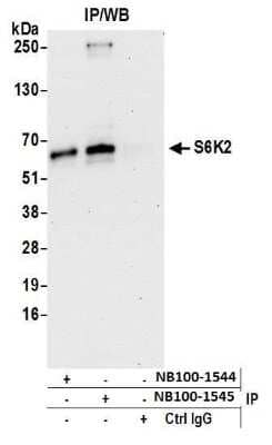 Immunoprecipitation: p70 S6 Kinase beta/S6K2 Antibody [NB100-1544] - Detection of human S6K2 by western blot of immunoprecipitates. Samples: Whole cell lysate (1.0 mg per IP reaction; 20% of IP loaded) from HeLa cells prepared using NETN lysis buffer. Antibodies: Affinity purified rabbit anti-S6K2 antibody NB100-1544 used for IP at 3 ug per reaction. S6K2 was also immunoprecipitated by rabbit anti-S6K2 antibody NB100-1545. For blotting immunoprecipitated S6K2, NB100-1545 was used at 1 ug/ml. Detection: Chemiluminescence with an exposure time of 30 seconds.