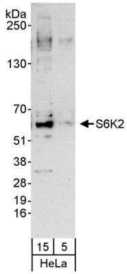 Western Blot: p70 S6 Kinase beta/S6K2 Antibody [NB100-1545] - Whole cell lysate (5 and 15 ug) from HeLa cells.  Antibody used at 0.04 ug/ml for WB.