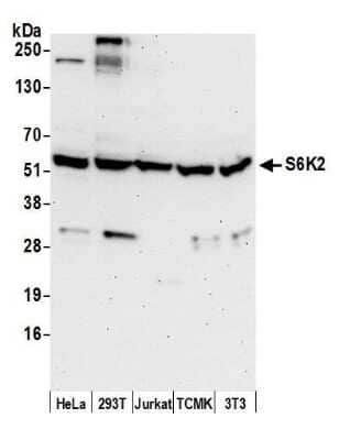 Western Blot: p70 S6 Kinase beta/S6K2 Antibody [NB100-1545] - Detection of human and mouse S6K2 by western blot. Samples: Whole cell lysate (50 µg) from HeLa, HEK293T, Jurkat, mouse TCMK-1, and mouse NIH 3T3 cells prepared using NETN lysis buffer. Antibody: Affinity purified rabbit anti-S6K2 antibody NB100-1545 used for WB at 0.1 µg/ml. Detection: Chemiluminescence with an exposure time of 30 seconds.