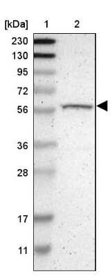 Western Blot: p70 S6 Kinase beta/S6K2 Antibody [NBP1-87805] - Lane 1: Marker  [kDa] 230, 130, 95, 72, 56, 36, 28, 17, 11.  Lane 2: Human cell line RT-412