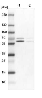 Western Blot: p70 S6 Kinase beta/S6K2 Antibody [NBP1-87805] - Lane 1: NIH-3T3 cell lysate (Mouse embryonic fibroblast cells) Lane 2: NBT-II cell lysate (Rat Wistar bladder tumour cells)