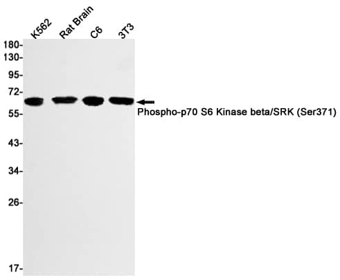 Western Blot: p70 S6 Kinase beta/S6K2 [p Ser371] Antibody (S01-4A5) [NBP3-19549] - Western blot detection of Phospho-p70 S6 Kinase beta/S6RK (Ser371) in K562, Rat Brain, C6, 3T3 cell lysates using NBP3-19549 (1:1000 diluted). Predicted band size: 54kDa. Observed band size: 60kDa.