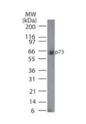 Western Blot: p73 Antibody (5B1288) - Azide Free [NBP2-33241] - Analysis of p73 in HeLa cell lysate (Cat no. NBP2-25045) using this antibody at 1 ug/mL. Image from the standard format of this antibody.