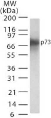 Western Blot: p73 Antibody (5B1288) - Azide Free [NBP2-33241] - Analysis of p73 in transfected cell lysate using this antibody. Image from the standard format of this antibody.