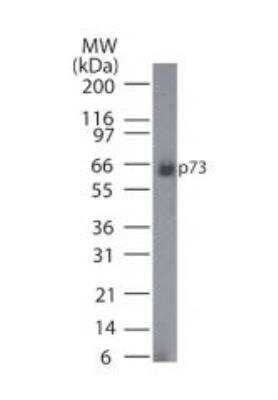 Western Blot: p73 Antibody (5B1288) [NB100-56674] - Analysis of p73 in HeLa cell lysate (Cat no. NBP2-25045) using this antibody at 1 ug/mL.