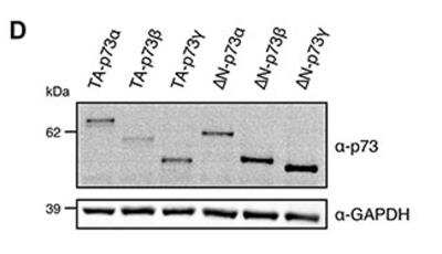 Western Blot: p73 Antibody (5B1288) [NB100-56674] - Analysis of the expression level of p73 isoforms. GAPDH was used as a loading control. Image collected and cropped by CiteAb from the following publication (//www.oncotarget.com/article/11774) licensed under a CC-BY license.