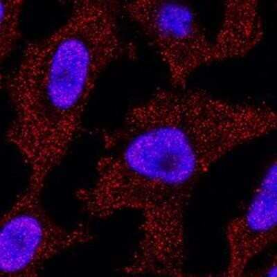 Immunocytochemistry/Immunofluorescence: p73 Antibody (5B429) - Azide Free [NBP2-33259] - p73 was detected in immersion fixed Hela human cell line using p73 [5B429] Monoclonal Antibody (Catalog # NBP2-24737) at 3 ug/mL for 3 hours at room temperature. Cells were stained using the NorthernLights(TM) 557-conjugated Anti-Mouse IgG Secondary Antibody (red; Catalog # NL007) and counterstained with DAPI (blue). Staining was observed in the cytoplasm and in the nuclei. Image from the standard format of this antibody.