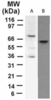 Western Blot: p73 Antibody (5B429) - Azide Free [NBP2-33259] - Analysis of p73 in A) transfected cell lysate and B) HeLa cell lysate at 2 ug/ml. Image from the standard format of this antibody.