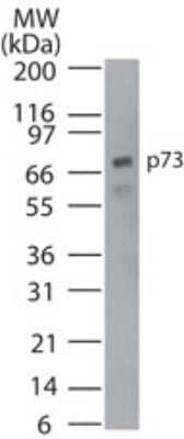 Western Blot: p73 Antibody (5B789) [NB100-56675] - Analysis of p73 in Rh30 cell lysate using this antibody at 2 ug/ml.