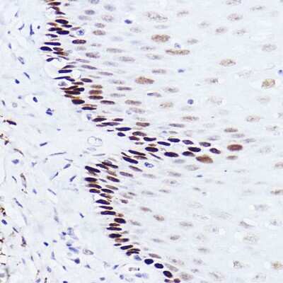 Immunohistochemistry-Paraffin: p73 Antibody (7L1V7) [NBP3-16142] - Immunohistochemistry of paraffin-embedded human esophageal using p73 Rabbit mAb (NBP3-16142) at dilution of 1:100 (40x lens).Perform high pressure antigen retrieval with 10 mM citrate buffer pH 6.0 before commencing with IHC staining protocol.