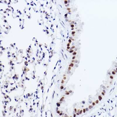 Immunohistochemistry-Paraffin: p73 Antibody (7L1V7) [NBP3-16142] - Immunohistochemistry of paraffin-embedded mouse lung using p73 Rabbit mAb (NBP3-16142) at dilution of 1:100 (40x lens).Perform high pressure antigen retrieval with 10 mM citrate buffer pH 6.0 before commencing with IHC staining protocol.