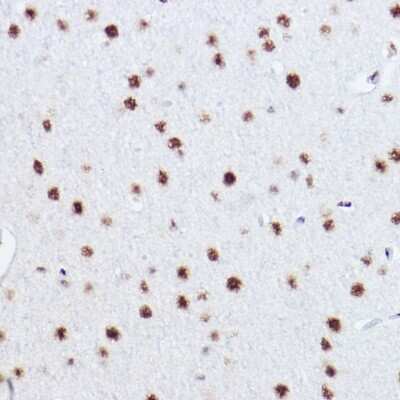 Immunohistochemistry-Paraffin: p73 Antibody (7L1V7) [NBP3-16142] - Immunohistochemistry of paraffin-embedded rat brain using p73 Rabbit mAb (NBP3-16142) at dilution of 1:100 (40x lens).Perform high pressure antigen retrieval with 10 mM citrate buffer pH 6.0 before commencing with IHC staining protocol.