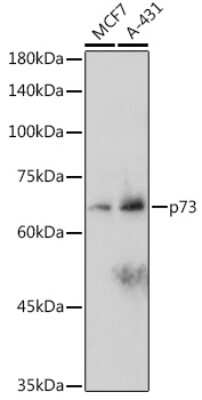 Western Blot: p73 Antibody (7L1V7) [NBP3-16142] - Western blot analysis of extracts of various cell lines, using p73 antibody (NBP3-16142) at 1:1000 dilution. Secondary antibody: HRP Goat Anti-Rabbit IgG (H+L) at 1:10000 dilution. Lysates/proteins: 25ug per lane. Blocking buffer: 3% nonfat dry milk in TBST. Detection: ECL Basic Kit. Exposure time: 180s.