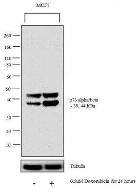 Western Blot: p73 Antibody (ER-15) [NB600-1279] - WB analysis was performed on nuclear enriched extracts (30 ug lysate) of MCF7 (Lane 1) and MCF7 treated with Doxorubicine (0.5 uM Doxorubicin for 24 hours) (Lane 2). The blot was probed with Anti-p73 alpha/beta Mouse Monoclonal Antibody. 