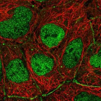 Immunocytochemistry/Immunofluorescence: p73 Antibody [NBP2-58335] - Staining of human cell line HEK 293 shows localization to nucleoplasm, cell junctions & vesicles.