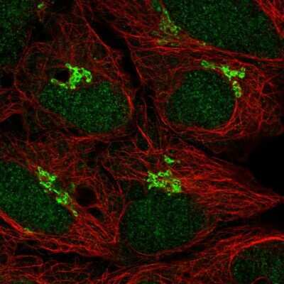 Immunocytochemistry/Immunofluorescence: p73 Antibody [NBP2-58523] - Staining of human cell line HEK 293 shows localization to nucleus & the Golgi apparatus.