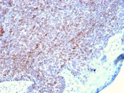 Immunohistochemistry-Paraffin: p73 Antibody (P73/2531) - Azide and BSA Free [NBP3-08760] - Formalin-fixed, paraffin-embedded human Skin stained with p73 Mouse Monoclonal Antibody (P73/2531).