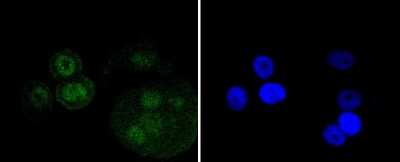 Immunocytochemistry/Immunofluorescence: p73 Antibody (ST05-76) [NBP2-67549] - Staining p73 in MCF-7 cells (green). The nuclear counter stain is DAPI (blue). Cells were fixed in paraformaldehyde, permeabilised with 0.25% Triton X100/PBS.