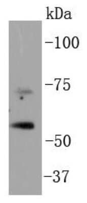 Western Blot: p73 Antibody (ST05-76) [NBP2-67549] - Analysis of p73 on Hela cell lysates using anti-p73 antibody at 1/1,000 dilution.