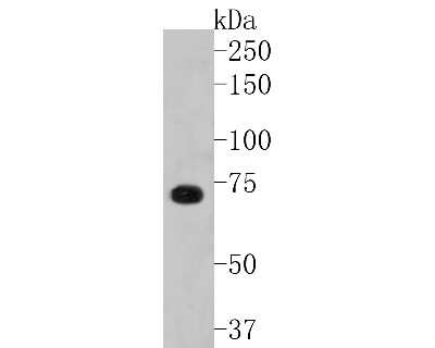 Western Blot: p73 Antibody (ST05-76) [NBP2-67549] - Western blot analysis of p73 on 293 cell lysates. Proteins were transferred to a PVDF membrane and blocked with 5% BSA in PBS for 1 hour at room temperature. The primary antibody (1/500) was used in 5% BSA at room temperature for 2 hours. Goat Anti-Rabbit