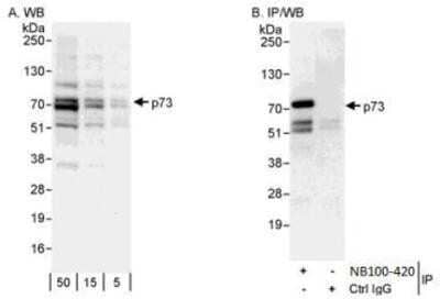 Western Blot: p73 Antibody [NB100-420] - Detection of Human p73 by Western Blot and   Immunoprecipitation.  Samples: Whole cell lysate (5, 15 and 50 ug for WB; 1 mg for IP, 20% of IP loaded) from 293T cells. Antibodies: Affinity purified rabbit anti-p73 antibody NB100-420 used for WB at 1 ug/ml (A and B) and used for IP at 3 ug/mg lysate. Detection: Chemiluminescence with exposure times of 10 seconds (A) and 30 seconds (B).