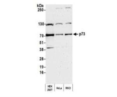 Western Blot: p73 Antibody [NB100-420] -  Whole cell lysate (50 ug) from HEK293T, HeLa, and RKO cells prepared using NETN lysis buffer. Antibody: Affinity purified rabbit anti-p73 antibody  used for WB at 0.1 ug/ml. Detection: Chemiluminescence with an exposure time of 75 seconds.