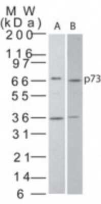 Western Blot: p73 Antibody [NB100-56435] - Analysis of p73 in A) transfected cell lysate and B) HeLa cell lysate using this antibody.