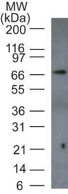 Western Blot: p73 Antibody [NB100-56435] - Western blot analysis of HeLa cell lysate (nuclear fraction) using p73 antibody at 3 ug/ml.