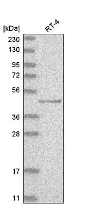 Western Blot: p73 Antibody [NBP2-58335] - Western blot analysis in human cell line RT-4.