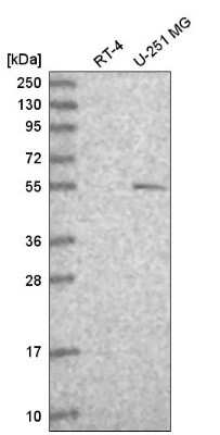 Western Blot: p73 Antibody [NBP2-58523] - Western blot analysis in human cell line RT-4 and human cell line U-251 MG.