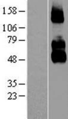 Western Blot: p75NTR Overexpression Lysate (Adult Normal) [NBL1-13635] Left-Empty vector transfected control cell lysate (HEK293 cell lysate); Right -Over-expression Lysate for p75NTR.