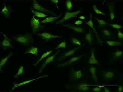 Immunocytochemistry/Immunofluorescence: p97/VCP Antibody (2H5) [H00007415-M15] - Analysis of monoclonal antibody to VCP on HeLa cell. Antibody concentration 10 ug/ml