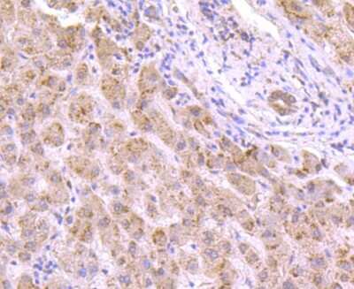 Immunohistochemistry-Paraffin: p97/VCP Antibody (JM11-15) [NBP2-67008] - Analysis of paraffin-embedded human liver tissue using anti-VCP antibody. Counter stained with hematoxylin.