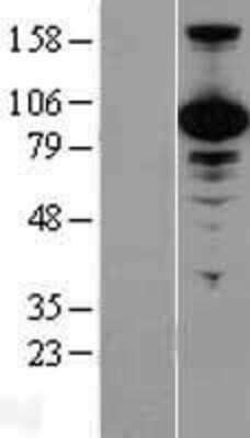 Western Blot: p97/VCP Overexpression Lysate (Adult Normal) [NBL1-17707] Left-Empty vector transfected control cell lysate (HEK293 cell lysate); Right -Over-expression Lysate for p97/VCP.