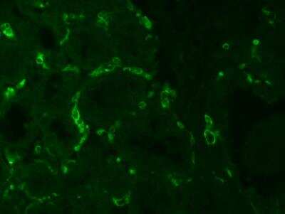 Immunohistochemistry-Paraffin: pIgR Antibody (SC05/COMPO2) - Azide and BSA Free [NBP2-47138] - Venules in the interalveolar stroma are positive for the pIgR antigen. Image from a verified customer review. Antigen retrieval by a microwave method in 0.01M citric acid (pH 6.0). Alex Fluor 488 anti-mouse antibody was used as a secondary detection antibody.