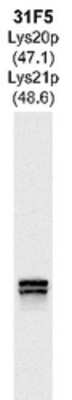 Western Blot: Lys20p and Lys21p Antibody [NBP1-05201] - Western blots of whole yeast protein extracts with a collection of our antibodies. The blot for NBP1-05201 is in the indicated lane, and the number indicates the SDS-PAGE molecular weight in kiloDaltons.