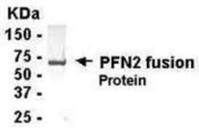 Western Blot: Profilin 2 Antibody[NB120-14251]-E coli-derived fusion protein as test antigen. Affi-anti-PFN2 IgY dilution: 1:2000, Goat anti-IgY-HRP dilution: 1:1000. Colorimetric method for signal development.