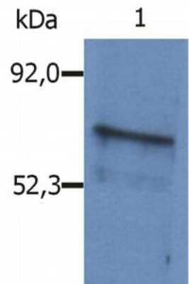 Western Blot: BLNK Antibody [NB500-542] - Fig. 1. Western Blotting analysis (reducing conditions) of whole cell lysate of Sp2/0 mouse myeloma cell line using polyclonal anti-mouse BLNK antibody.