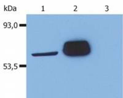 Western Blot: Lck Antibody (LCK-01) [NB500-336] - Fig. 1. Western Blotting analysis (reducing conditions) of human Lck in whole cell lysate using anti-human Lck (LCK-01). Lane 1: J. CaM-1.6 cell line (a mutant derivate of the JURKAT cell line) transfected with Lck Lane 2: HEK-293T cell line transfected with Lck Lane 3: HEK-293T cell line (non-transfected).