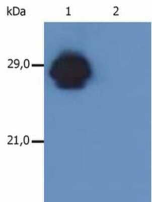 Western Blot: HLA DR DP Antibody (MEM-136) [NB500-447] - Fig. 1. Western Blotting analysis of MHC Class II in whole cell lysate of RAJI human Burkitt lymphoma cell line using anti-human HLA-DR+DP (MEM-136). The antibody MEM-136 recognizes beta-chain of HLA-DR antigen under non-reducing conditions. Lane 1: immunostaining with anti-human HLA-DR+DP (MEM-136) Lane 2: immunostaining with Isotype mouse IgG1 control (PPV-06).