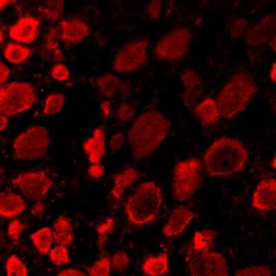 Immunohistochemistry ACCN1 Antibody - BSA Free