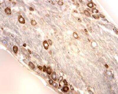 Immunohistochemistry: Amiloride-sensitive cation channel 3 Antibody [NB100-2067] - ASIC3 labeling is done on cryostat sections of rat DRG using HRP-DAB detection (brown color).