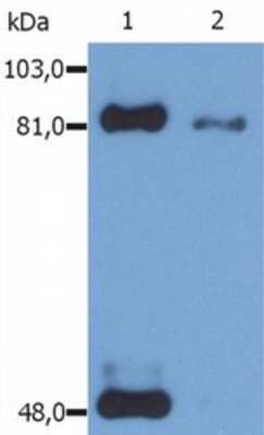 Western Blot: STAT1 [p Ser727] Antibody (PSM1) [NB500-515] - Analysis (reducing conditions) of phosphorylated STAT1 (Ser727) in IFN-a treated HeLa human cervix carcinoma cell line using anti-Phospho STAT1 (PSM1). Lane 1: immunoprecipitated material by anti-STAT1 (SM2) Lane 2: original whole cell lysate.