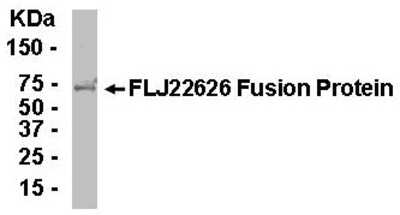 Western Blot: E coli-derived fusion protein as test antigen. Affinity-purified IgY dilution: 1:2000, Goat anti-IgY-HRP dilution: 1:1000. Colorimetric method for signal development. (anti-NKAP)