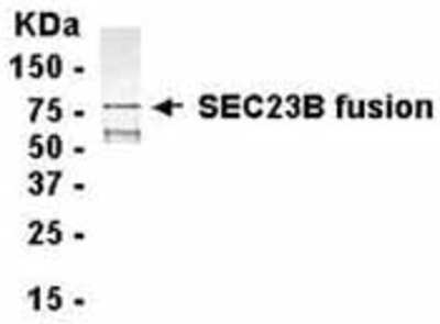 Western Blot: E coli-derived fusion protein as test antigen. Affinity-purified IgY dilution: 1:2000, Goat anti-IgY-HRP dilution: 1:1000. Colorimetric method for signal development. ( anti-SEC23B )